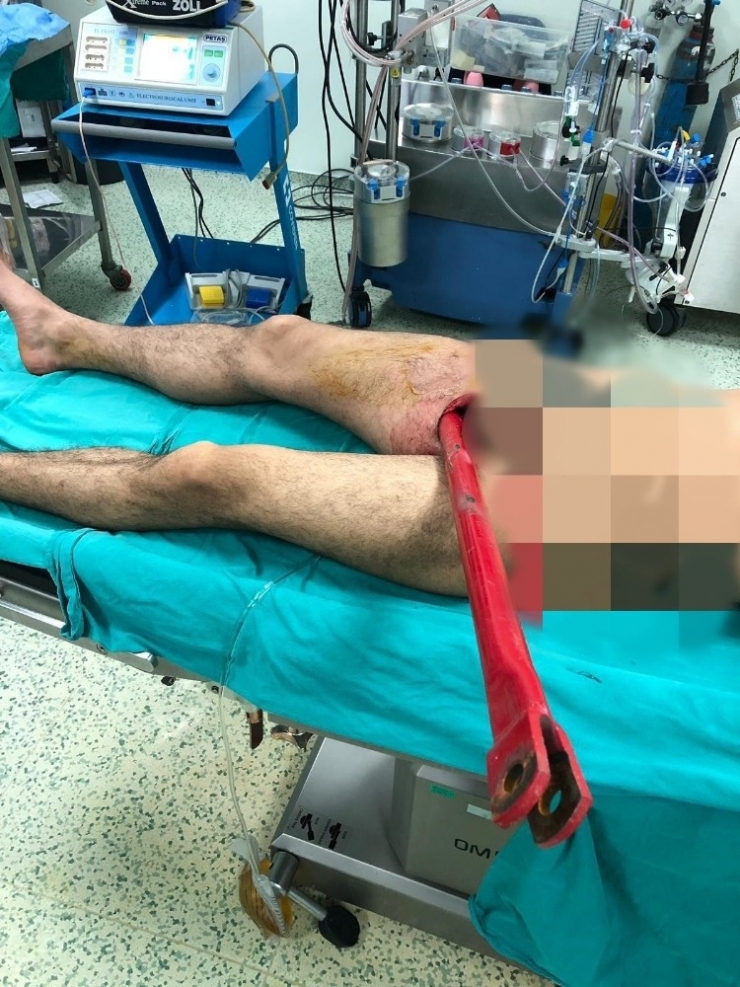 Bacağına Pulluk Demiri Saplandı