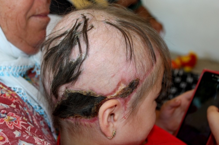 Bir Anlık Dikkatsizlik Minik Ezginaz’a Dehşeti Yaşattı