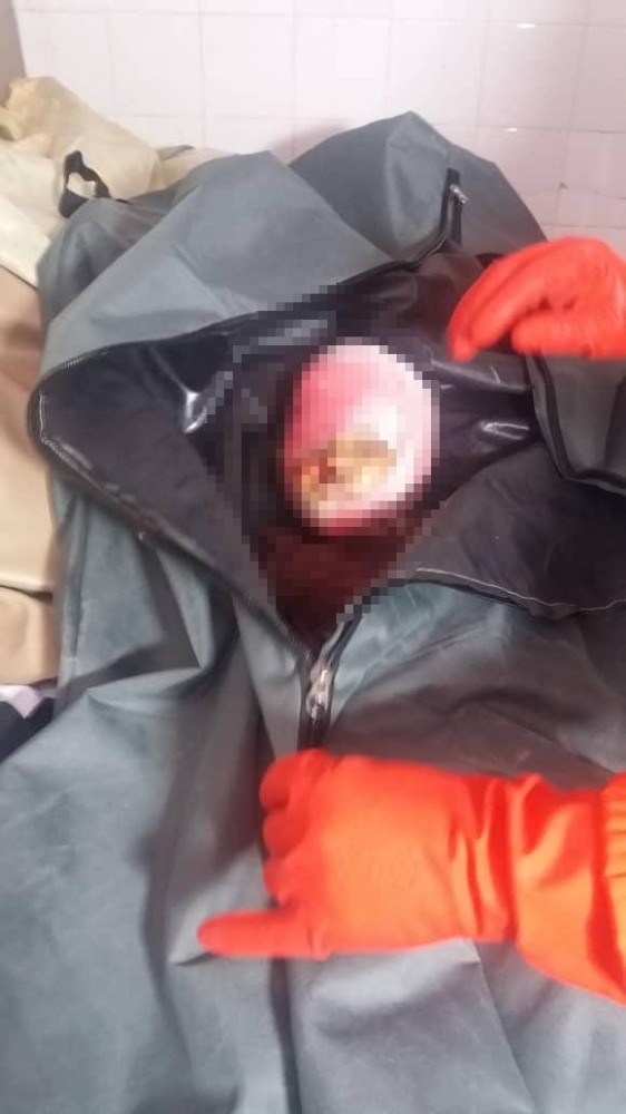 Kabil’de 3 Patlama: 7 Ölü, 21 Yaralı