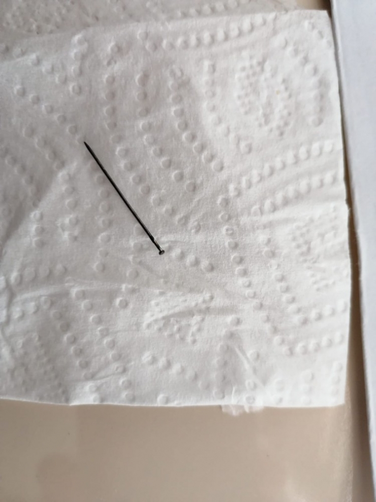 Yanlışlıkla Yuttuğu İğne 3 Ay Sonra Operasyonla Çıkarıldı