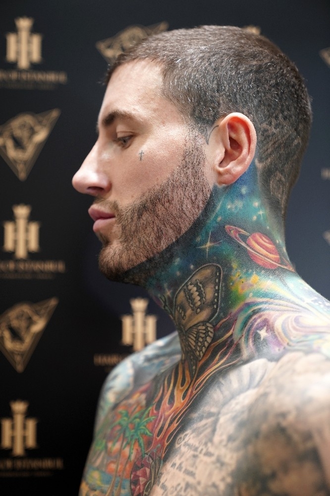 Türkiye’deki Saç Ekimi Dünyaca Ünlü İsimleri Cezbediyor