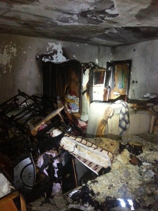 Alanya’da Küle Dönen Evden Kolundaki Yanıkla Kurtuldu