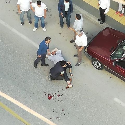 Ayağının Üzerinden Tır Geçen Şahıs Yaralandı