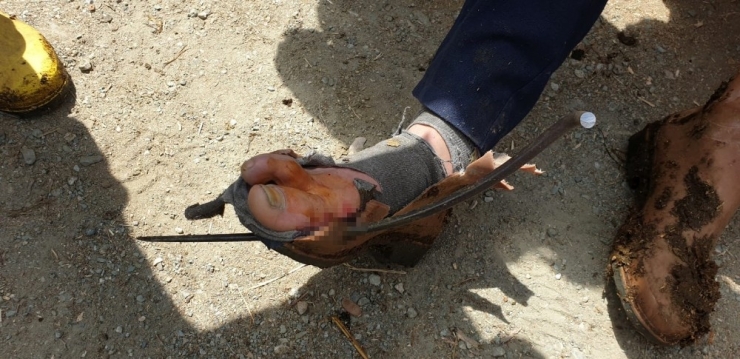 Ayağına Yaba Saplandı