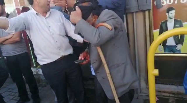 Ağrı’da Muhtarlık Kavgası: 7 Yaralı