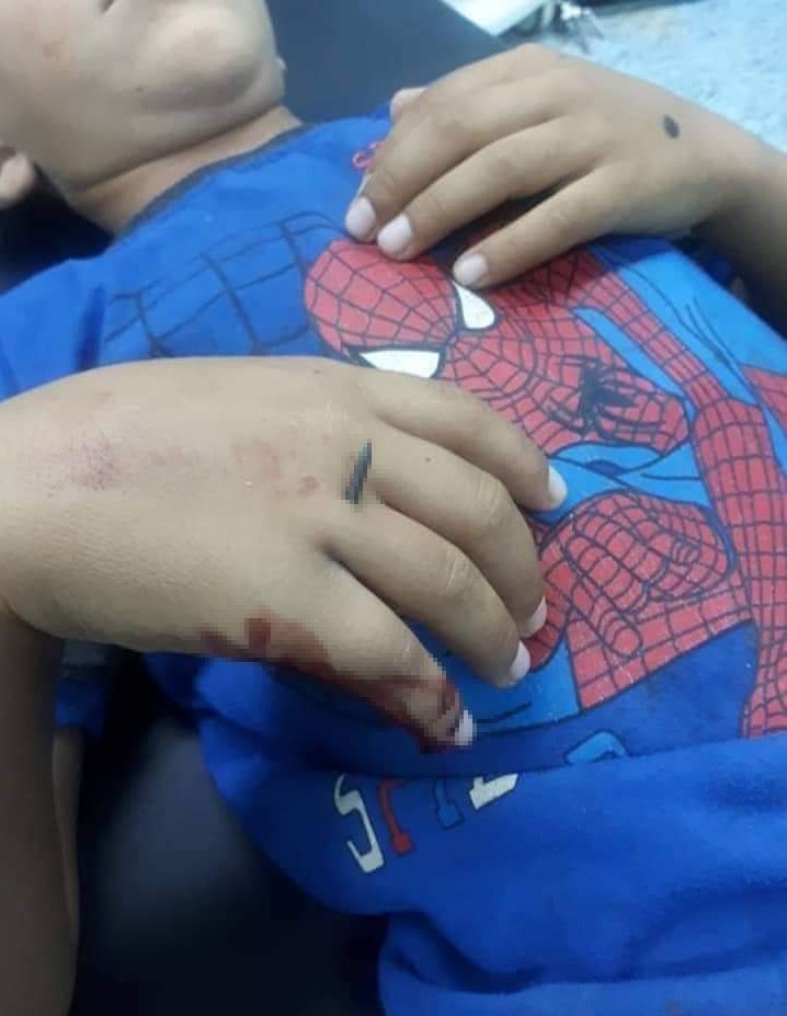 Esad Rejimi, Çivi Bombaları Kullanmaya Devam Ediyor