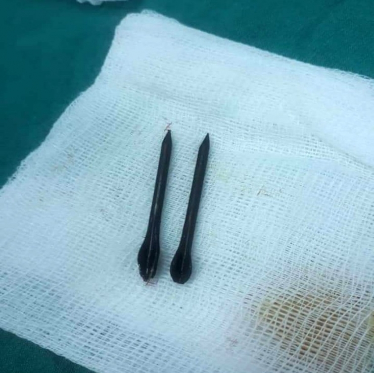 Esad Rejimi, Çivi Bombaları Kullanmaya Devam Ediyor