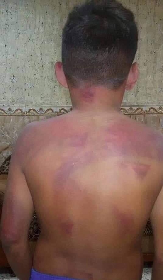 Iraklı Baba 70 Lira İçin Çocuğunu Öldüresiye Dövdü