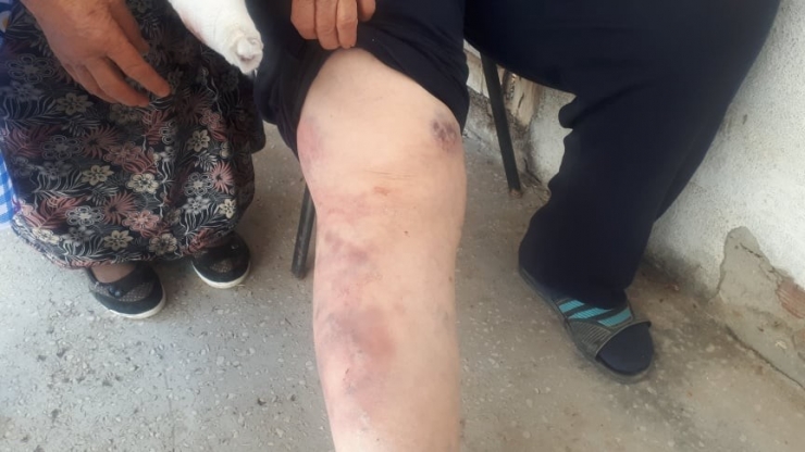 Eniştelerini Hastanelik Edince Kadar Dövdüler