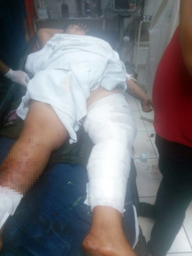 Tarsus’ta Kar Maskeliler Tarafından Silahlı Saldırı: 2’si Ağır 4 Çocuk Yaralandı