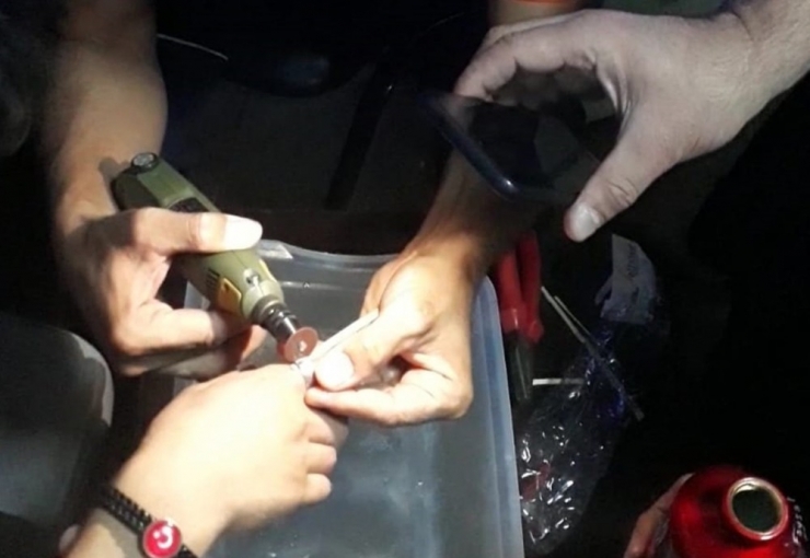 Parmağa Sıkışan Yüzüğü Afad Ekibi Çıkardı