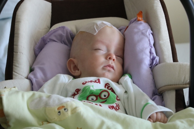 Prematüre Bebeğe Beyin Ameliyatı