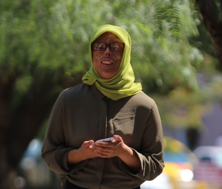 Yüz Nakli Heyecanı Saran Leyla Öğretmen Olmak İstiyor