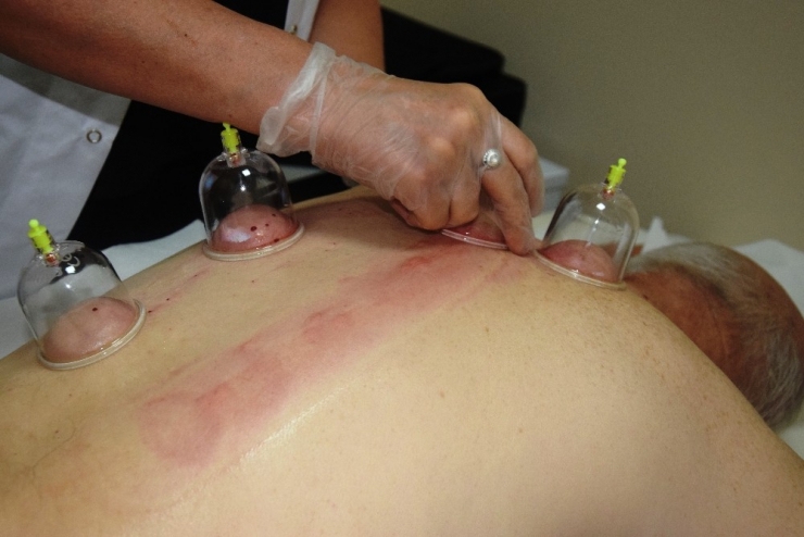 Akupunktur, Ozon Tedavisi, Nöralterapi İle Sağlığına Kavuştu