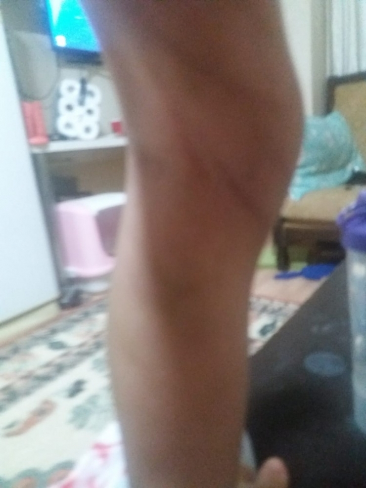 Minik Eymen’in Ölümünde İhmal İddiası