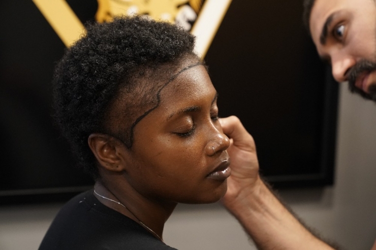 "Hair Of İstanbul Olarak ’Alın Daraltma’ Operasyonlarına Başladık"