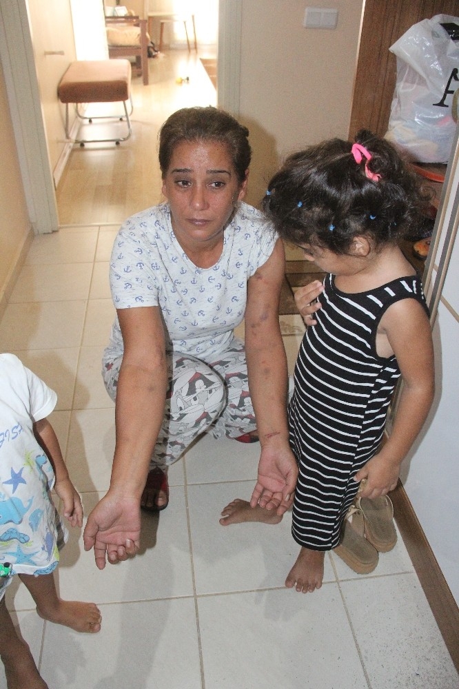 Birlikte Yaşadığı Erkek Tarafından Darp Edildi