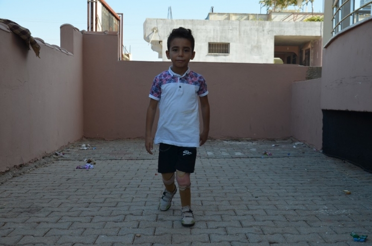 Suriyeli Yetim Muhammed, Kaybettiği Bacaklarına Türkiye’de Kavuştu