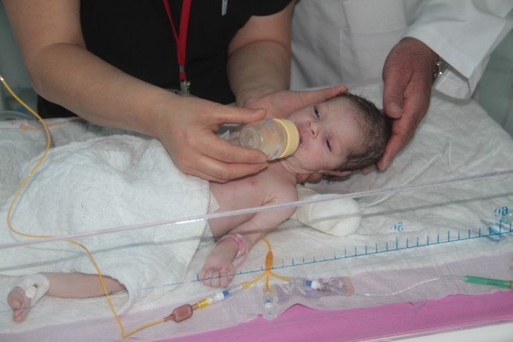 Doğduktan 24 Saat Sonra Yapılan ‘Yemek Borusu’ İle Hayata Tutundu