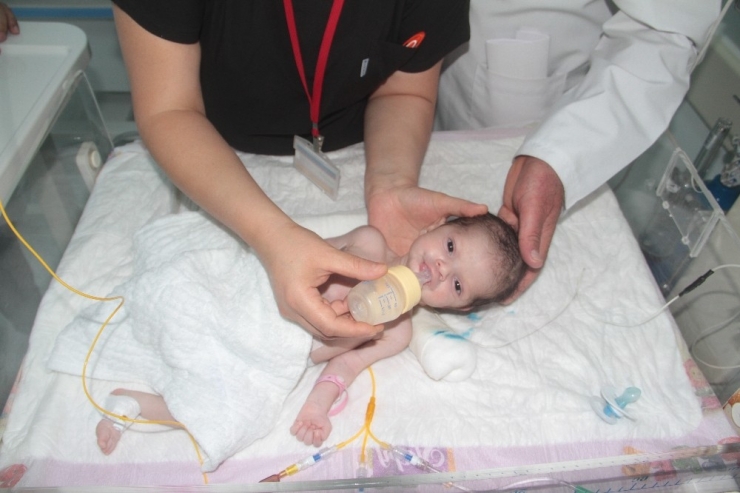 Doğduktan 24 Saat Sonra Yapılan ‘Yemek Borusu’ İle Hayata Tutundu