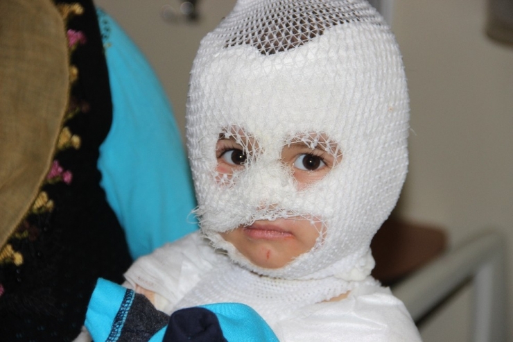 Isıtıcıdaki Kaynar Su Üzerine Dökülen Çocuk Ölümden Döndü