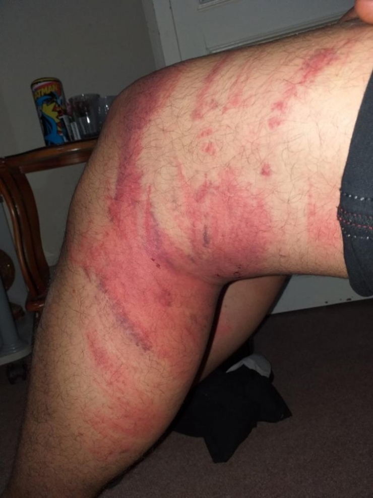 Çırağını Triger Kayışıyla Döven Usta Tutuklandı