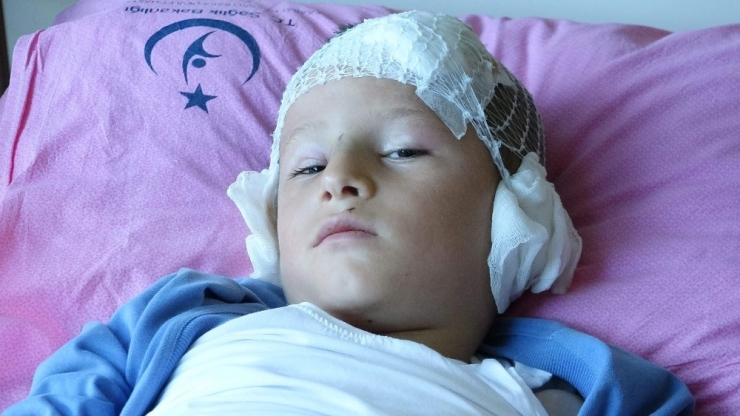 4. Kattan Düşen Sıva Parçası Az Daha Öldürüyordu