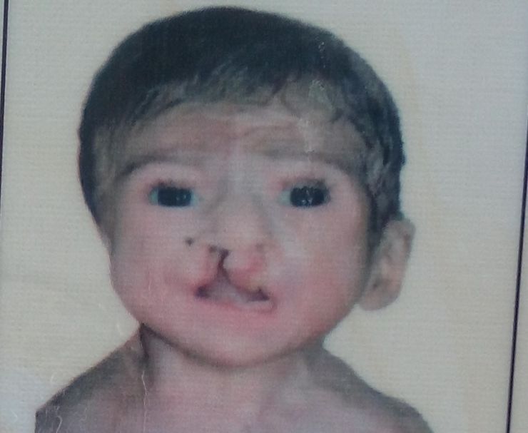 Antalya’da 5 Aylık Suriyeli Bebeğin Ölümü