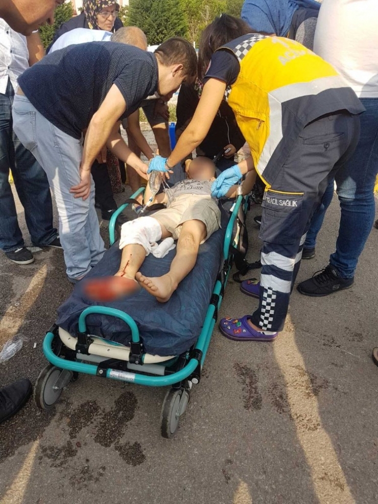 Bisikletten Düşen Çocuğun Ayağına Demir Saplandı