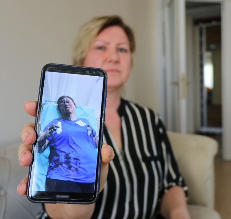 İş Kadınının Yüzüne Yanıcı Madde Döküp Tehdit Ettiler