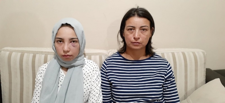 17 Yaşındaki Kızı Köpek Yüzünden Acımasızca Darp Ettiler