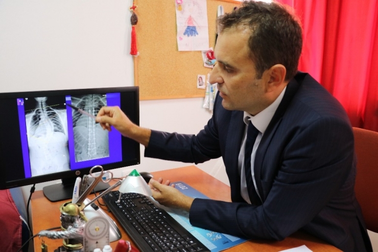 19 Yaşındaki Onur 10 Saatlik Skolyoz Ameliyatıyla Sağlığına Kavuştu