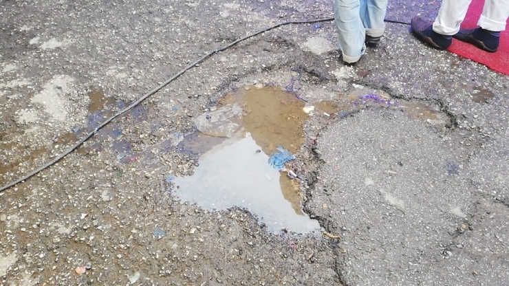 Çukur 75 Yaşındaki Kadını Hastanelik Etti