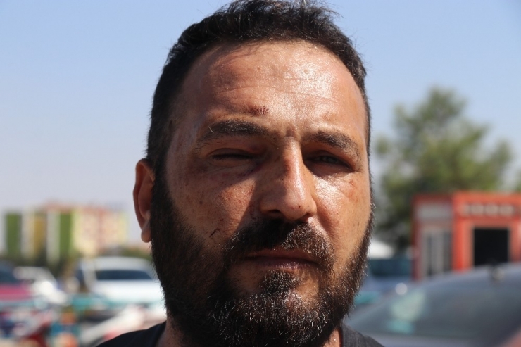 Hastanedeki Kavgada Sağlık Çalışanının Kolu Kırıldı, Hasta Yakını İse Darp Raporu Aldı