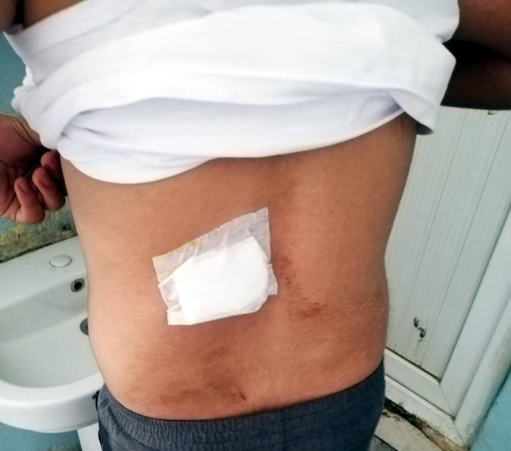 Damda Uyuyan Genç Kanlar İçerisinde Uyandı