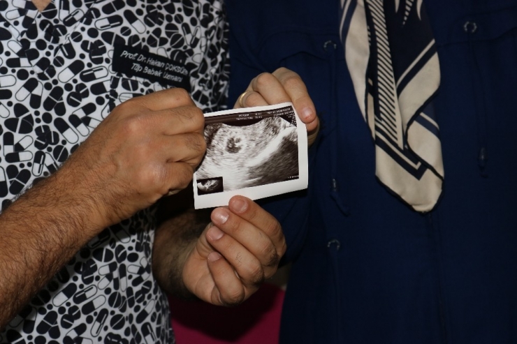 Prp Tedavisiyle 25 Yıllık Çocuk Hasreti Son Buldu