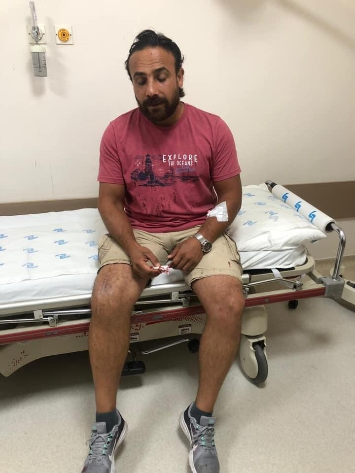 Başkent’te Terör Gazisine Çirkin Saldırı