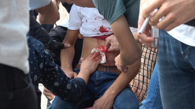 Bıçaklanarak Kanlar İçinde Kaldı Cep Telefonuyla Olayı Arkadaşına Anlattı