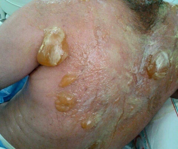 Terör Örgütünün "Kimyasal Bomba" Yalanı Madde Madde Böyle Boşa Çıkarıldı