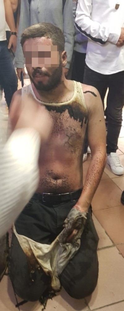 Eşiyle Tartışınca Sokakta Kendini Yaktı