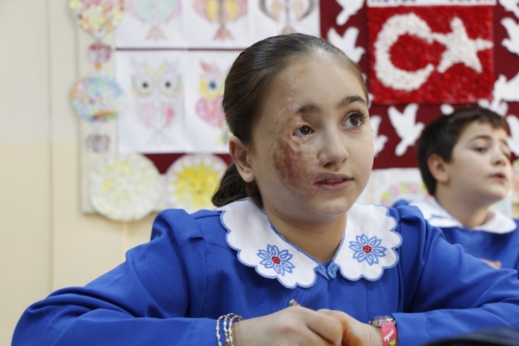 Luceyn Ve Ömer’in Yüzü Türkiye’de Güldü