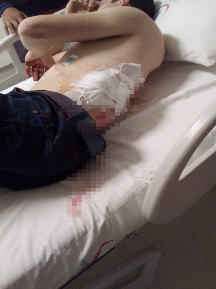 İstanbul’da Önüne Gelene Bıçakla Saldıran Şahsın Saldırı Anları Kamerada