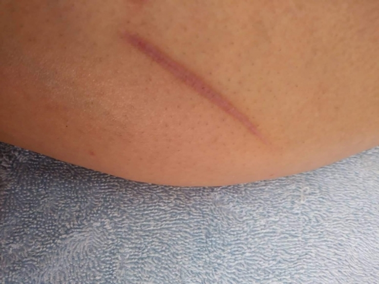 Çocuklarını İstedi İşkence Gördü