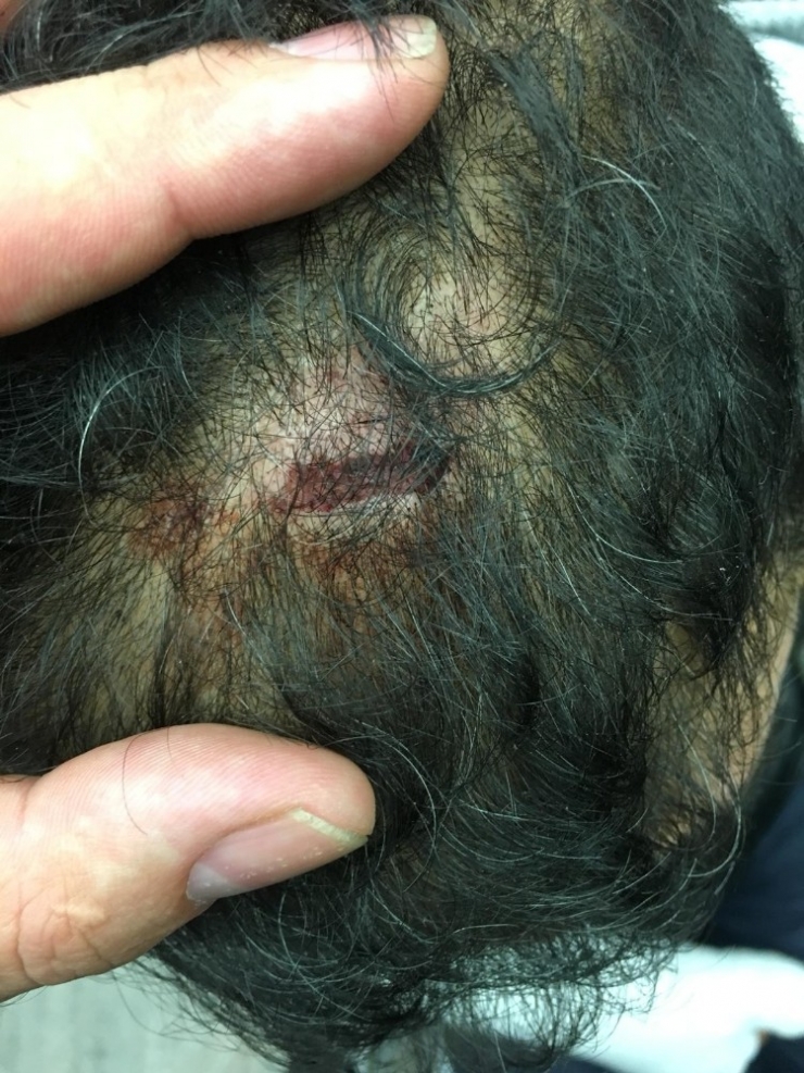 Alman Polisi Öldüresiye Darp Ettikleri Türkü Sokağa Bıraktı