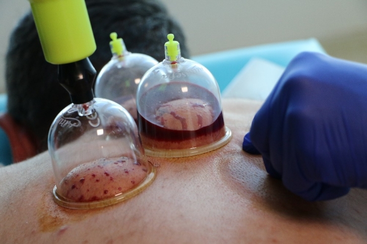 "Geleneksel Tıp Uygulamaları Modern Tıpa Işık Tutuyor"