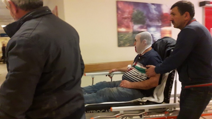 Kopan Vincin Demiri Suratına Çarptı