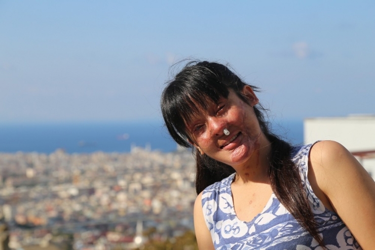 Berfin’in Yüzü Gülüyor