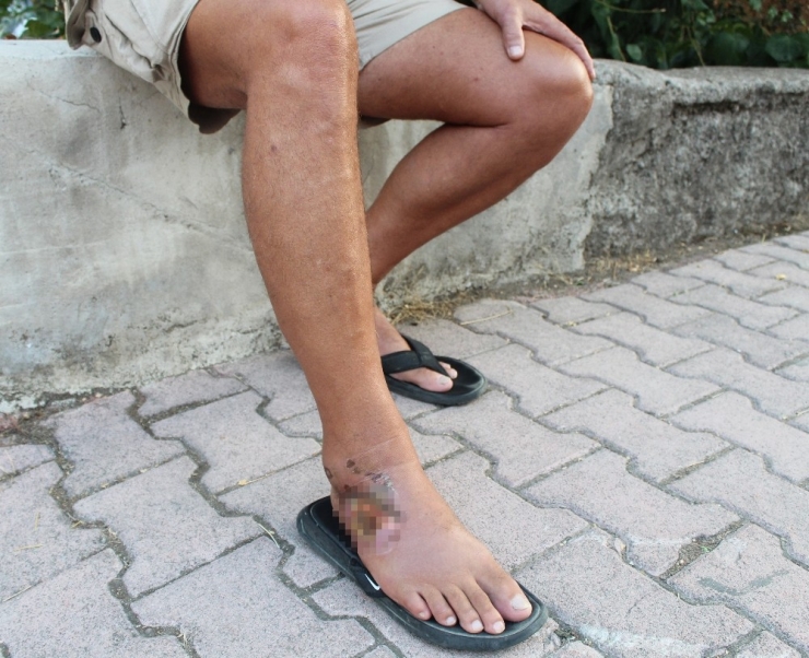 Aslan Balığının Zehirlediği Balıkçı: "Bir Daha Yanından Bile Geçmem"