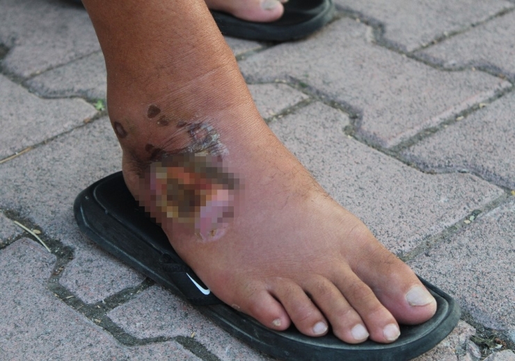 Aslan Balığının Zehirlediği Balıkçı: "Bir Daha Yanından Bile Geçmem"