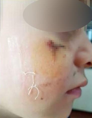 Öğrencisini Kitapla Yaralayan Öğretmen Hakkında Karar: 4 Yıl 2 Ay Hapis